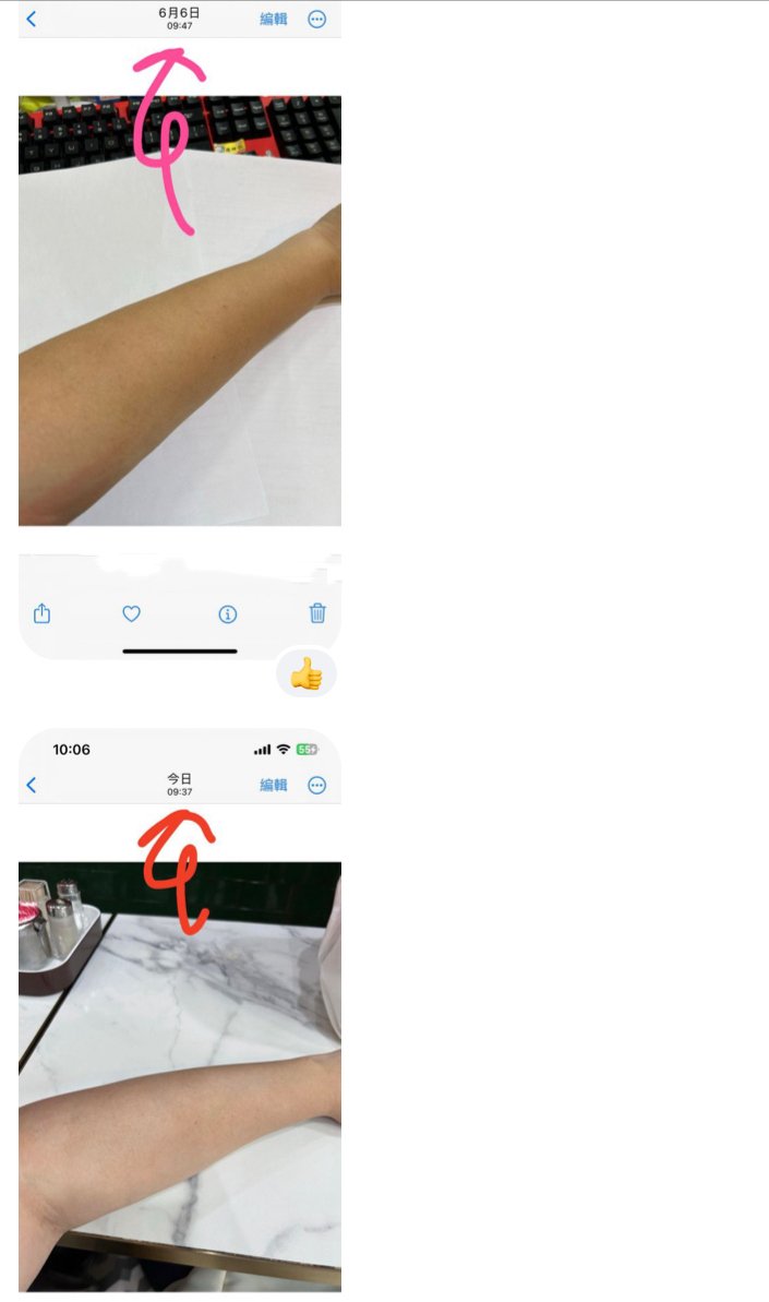 分子冰肌丸 好評9:30+女性,食左冰肌丸大約一個月,1日2粒,覺得效果比想像中有驚喜,原本隻手好黑、而家淡色左啲。腸胃都好左,平時我都有食開生菌,但都感覺到好似再清啲,同埋之前啲千年暗瘡印都淡化左。 - 新康來 FRESHLITE|日本No.1後生元專家